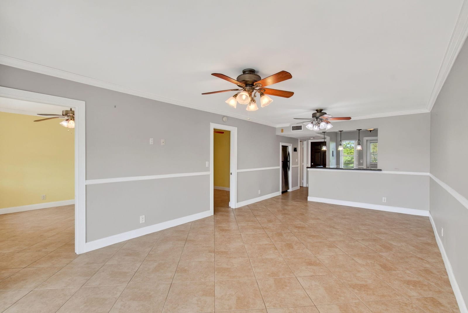 2871 N OCEAN Boulevard N V345 — photo 10